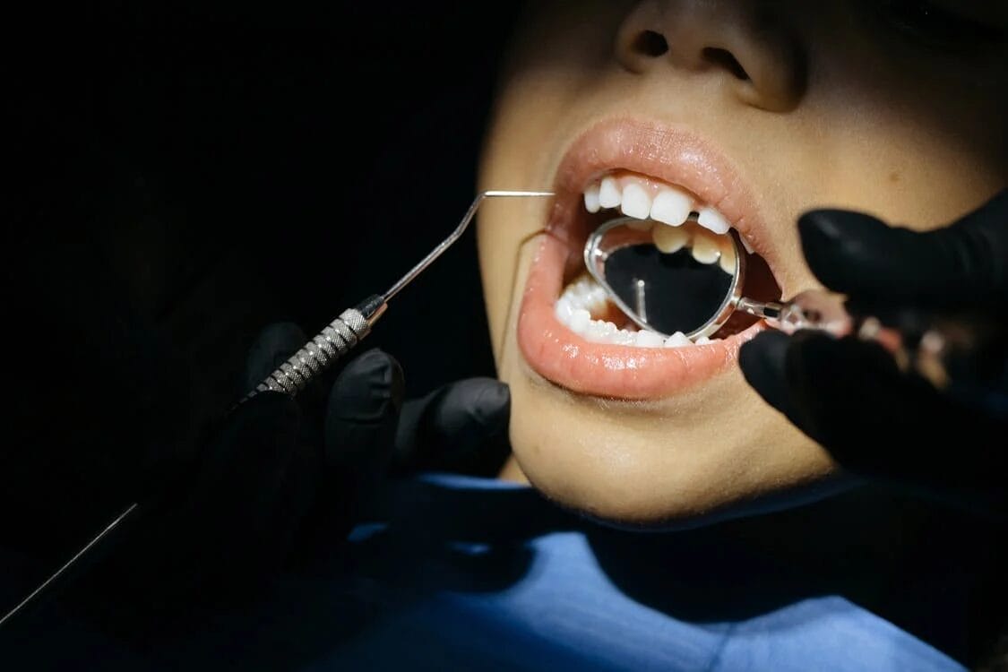 dental hygiene in early years